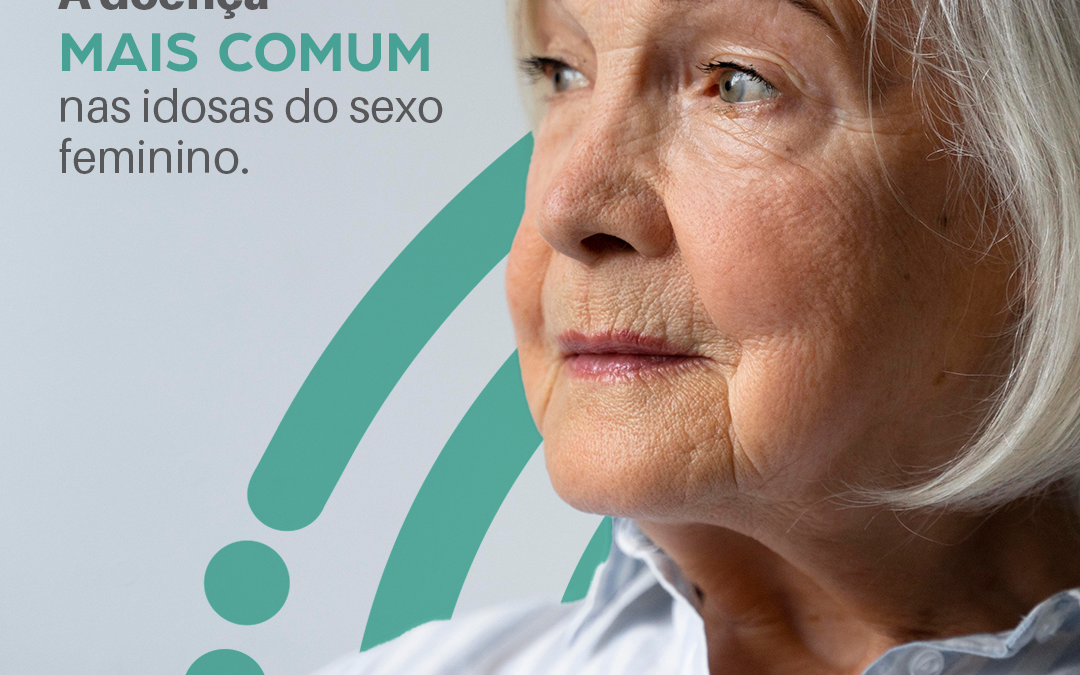Imagem Polimialgia Reumática: A doença mais comum nas idosas do sexo feminino