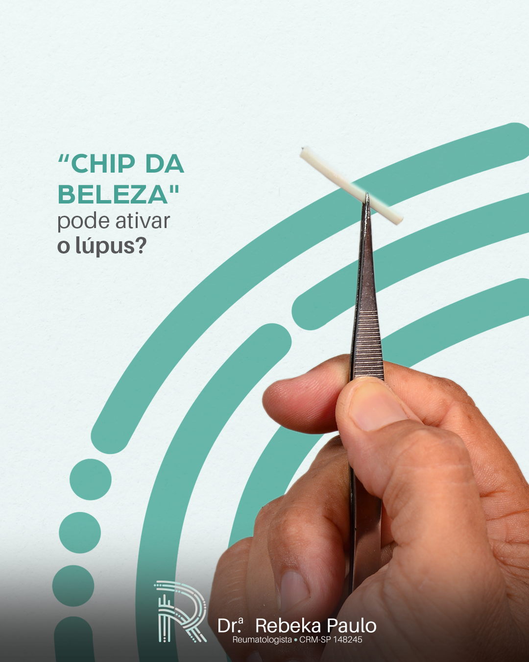 Imagem “Chip da beleza" pode ativar o lúpus?
